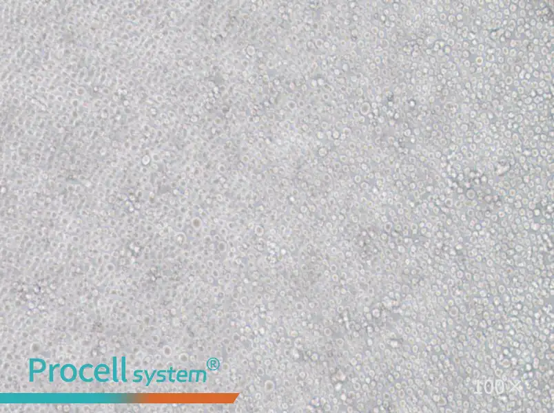 YT Cell Complete Medium - 1