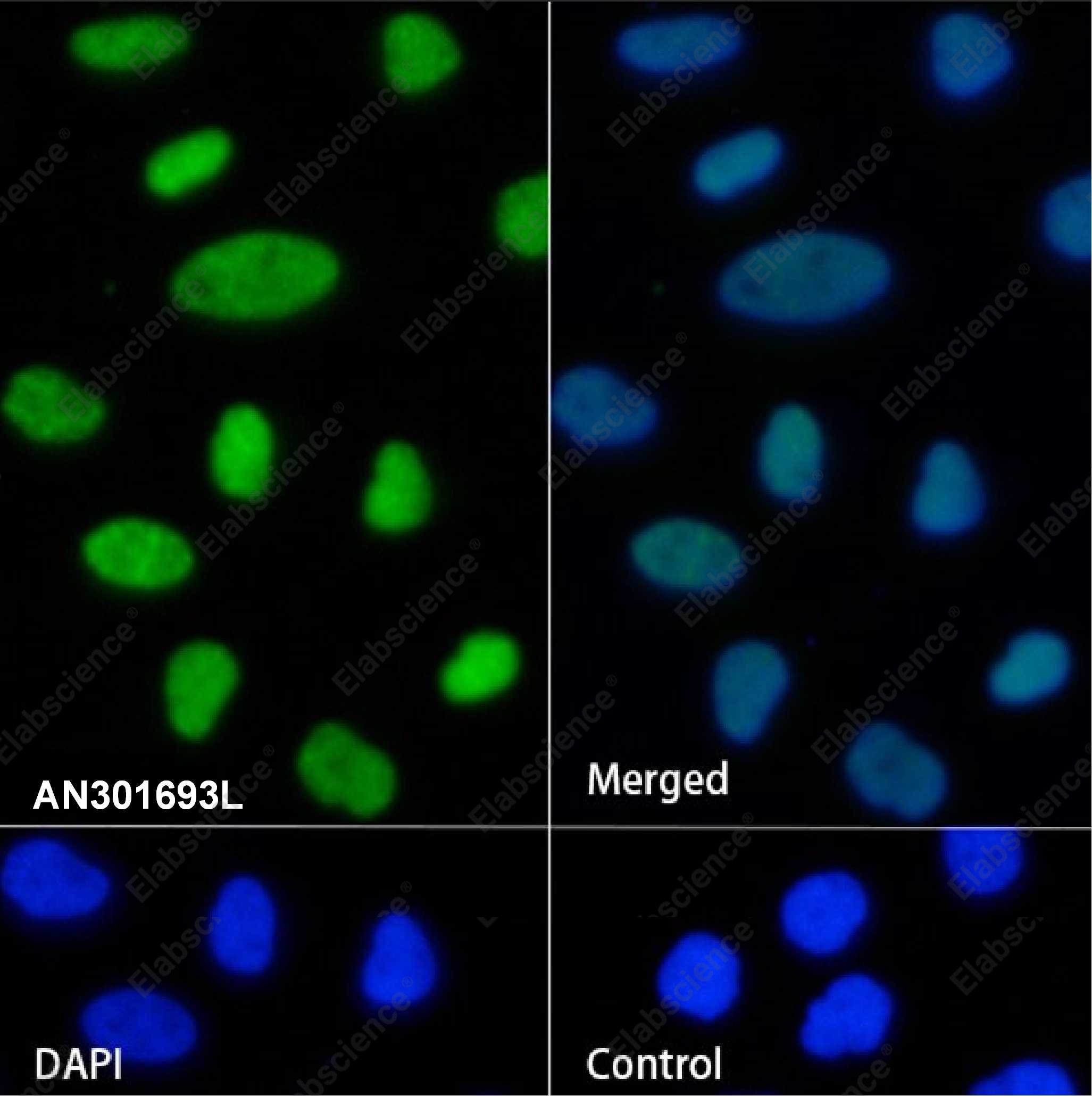 Recombinant KDM2A Monoclonal Antibody - 2