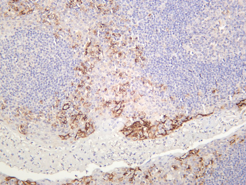 Recombinant CD31 Monoclonal Antibody - 3