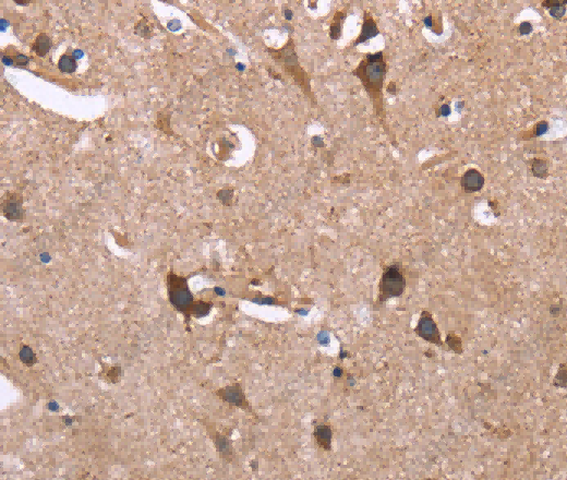 SERPINA1 Polyclonal Antibody - 3