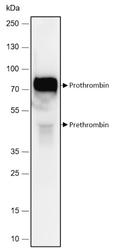 Recombinant Prothrombin Monoclonal Antibody - 2