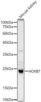 Western blot analysis of Mouse kidney using HOXB7 Polyclonal Antibody at 1:1000 dilution.