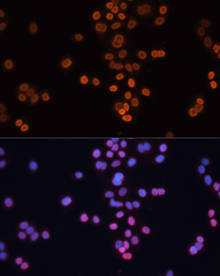 Immunofluorescence analysis of HT-29 cells using CDX2 Polyclonal Antibody at dilution of 1:100. Blue: DAPI for nuclear staining.