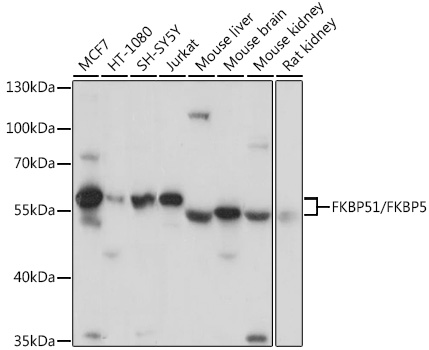 Western blot analysis of extracts of various cell lines using FKBP51/FKBP51/FKBP51/FKBP5 Polyclonal Antibody at 1:3000 dilution.