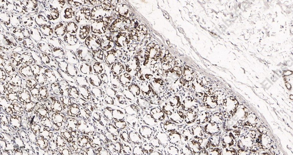 Recombinant UQCRC2 Monoclonal Antibody - 3