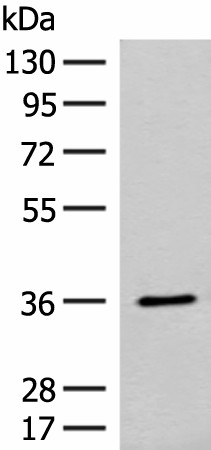 Western blot analysis of Mouse small intestines tissue lysate  using FAM84A Polyclonal Antibody at dilution of 1:300