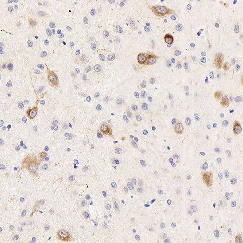 Immunohistochemistry analysis of paraffin-embedded rat brain  using DLL3 Polyclonal Antibody at dilution of 1:300.