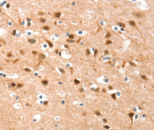 Immunohistochemistry of paraffin-embedded Human brain  tissue using DSC1 Polyclonal Antibody at dilution 1:40