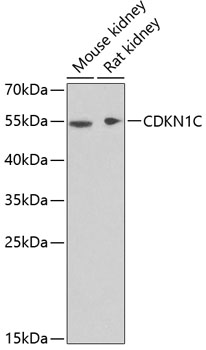 Western blot analysis of extracts of various cell lines using CDKN1C Polyclonal Antibody at dilution of 1:1000.