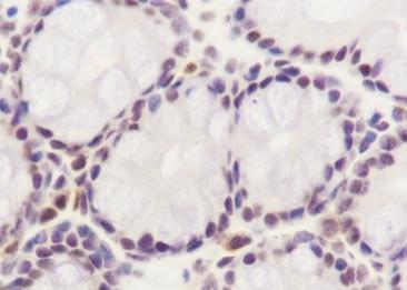 Recombinant SF3B3 Monoclonal Antibody-searchlist-2