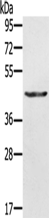 Western Blot analysis of A549 cell using KRT31 Polyclonal Antibody at dilution of 1:500