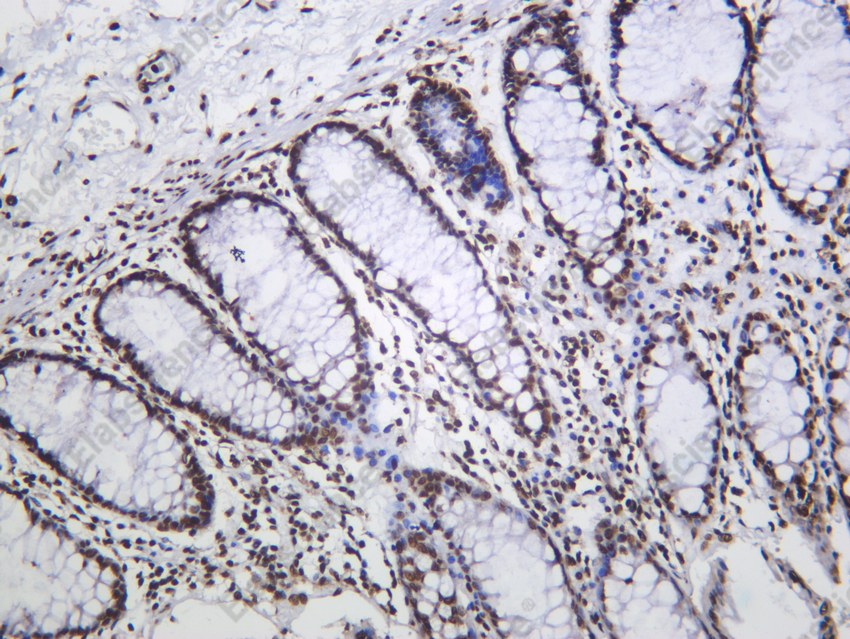 Recombinant Histone H4 (Acetyl Lys5) Monoclonal Antibody - 2