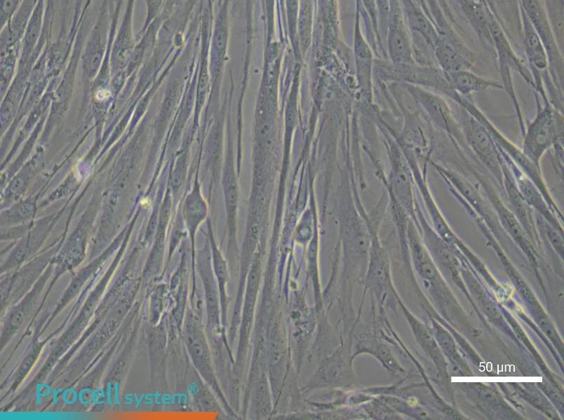 Human Tracheal Fibroblast Complete Medium - 5