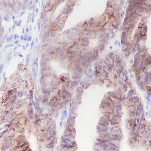 Recombinant Claudin-7 Monoclonal Antibody - small - 4