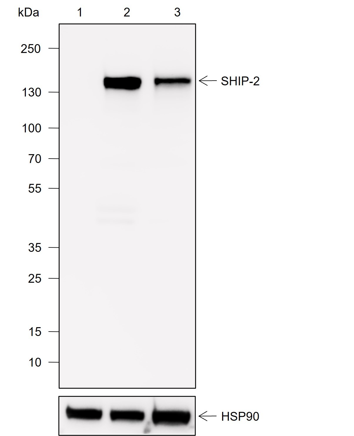 Recombinant SHIP-2 Monoclonal Antibody - small - 1