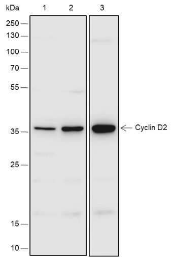 Recombinant Cyclin D2 Monoclonal Antibody-searchlist-1