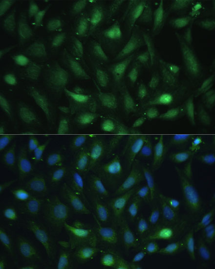 Immunofluorescence analysis of U-2 OS cells using CSNK2B Polyclonal Antibody at dilution of  1:100 (40x lens). Blue: DAPI for nuclear staining.