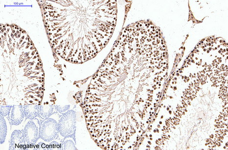 Immunohistochemistry of paraffin-embedded Rat testis tissue using PGR Monoclonal Antibody at dilution of 1:200.