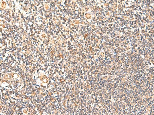 Immunohistochemistry of paraffin-embedded Human tonsil tissue  using GPD1L Polyclonal Antibody at dilution of 1:60(?200)