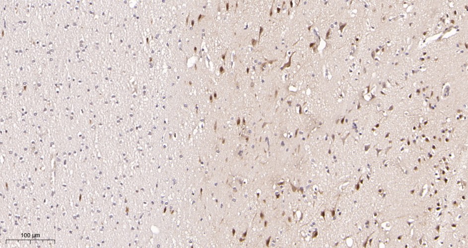 Recombinant TBR1 Monoclonal Antibody - small - 2