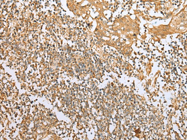 Immunohistochemistry of paraffin-embedded Human tonsil tissue  using NDUFB3 Polyclonal Antibody at dilution of 1:25(?200)