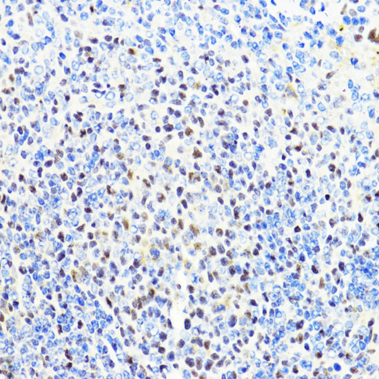 Immunohistochemistry of paraffin-embedded Mouse spleen using CTCF Polyclonal Antibody at dilution of 1:100 (40x lens).