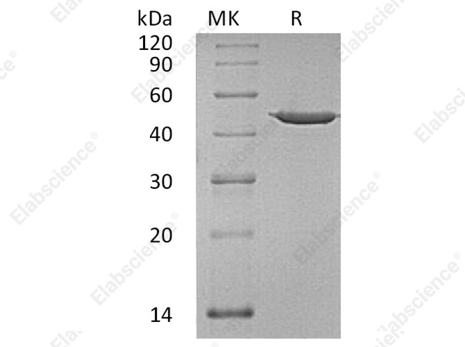 Recombinant Human Annexin A7/ANXA7 Protein - 1