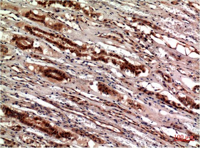 Immunohistochemistry of paraffin-embedded Human kidney tissue using CST3 Monoclonal Antibody at dilution of 1:200.