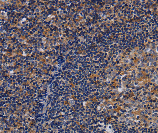 Immunohistochemistry of paraffin-embedded Human tonsil using LIMS1 Polyclonal Antibody at dilution of 1:40