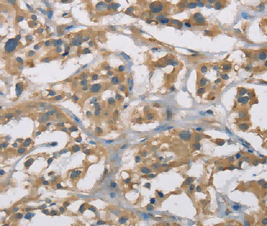 CYR61 Polyclonal Antibody - 2