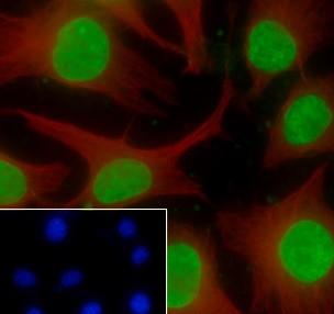 Recombinant Histone H3 (Mono Methyl Lys36) Monoclonal Antibody - small - 6