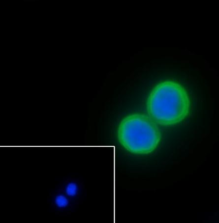 Recombinant Keratin 20 Monoclonal Antibody - 3