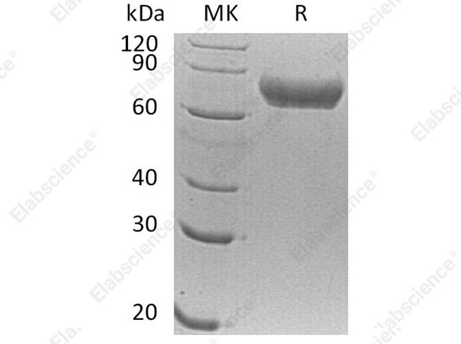 Recombinant Human FLRT1 Protein (His Tag) - 1