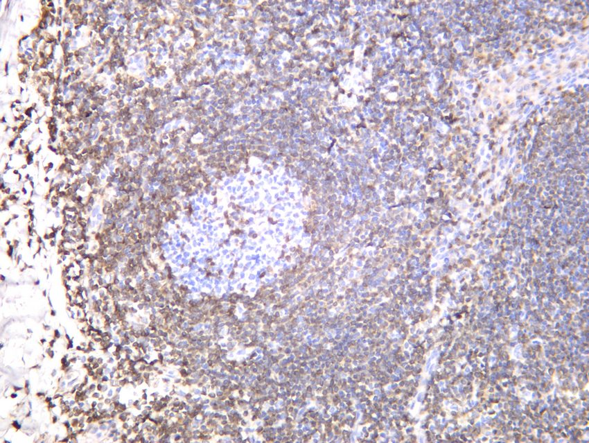Recombinant Bcl-2 Monoclonal Antibody - small - 6