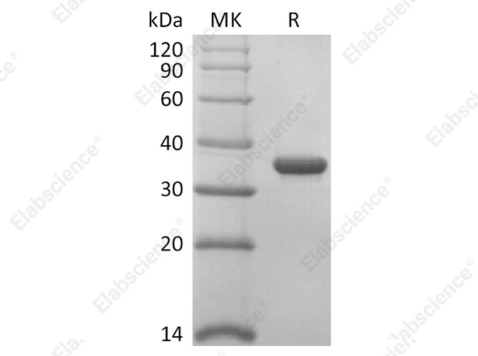 Recombinant SARS-CoV-2 Papain-Like Protease Protein - 1