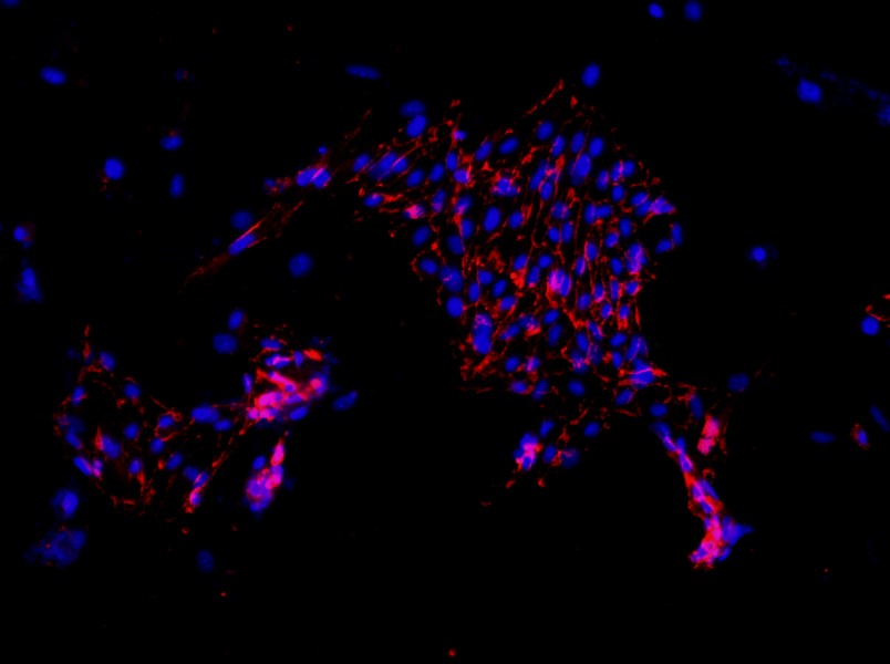 Mouse Pulmonary Great Artery Endothelial Cell Complete Medium - 3