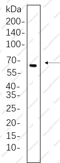 Recombinant Estrogen Receptor α Monoclonal Antibody - 1