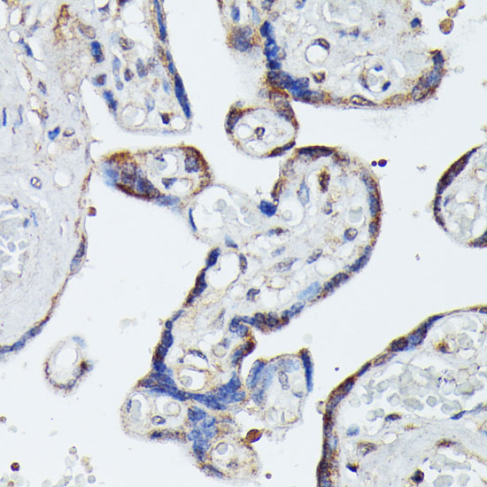 Immunohistochemistry of paraffin-embedded human placenta using MAP3K4 Polyclonal Antibody at dilution of 1:100 (40x lens).Perform microwave antigen retrieval with 10 mM PBS buffer pH 7.2 before commencing with IHC staining protocol.