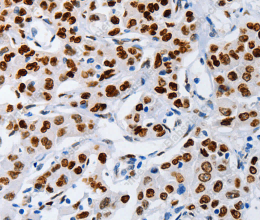 MUTYH Polyclonal Antibody - 2