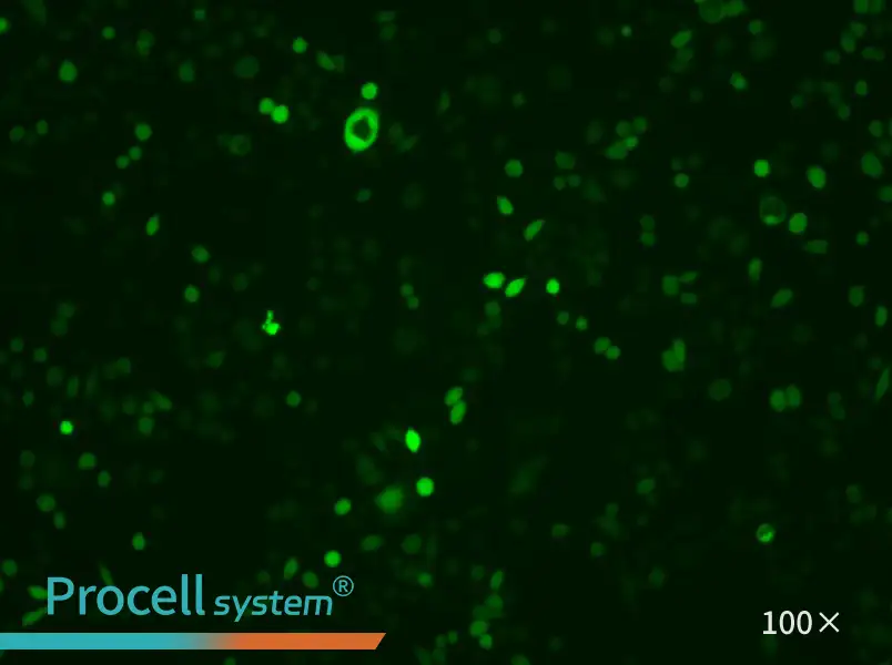 AGS-LUC-EGFP Cell Complete Medium - 3