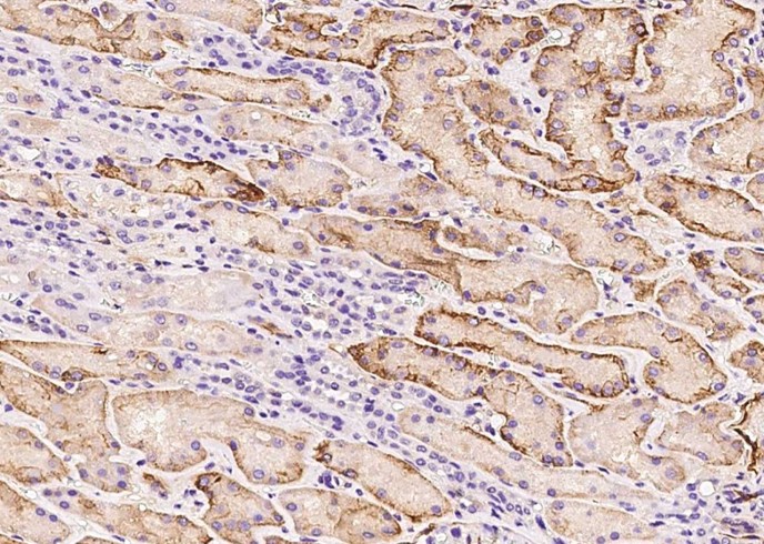 VCAM1/VCAM-1/CD106 Monoclonal Antibody - small - 3