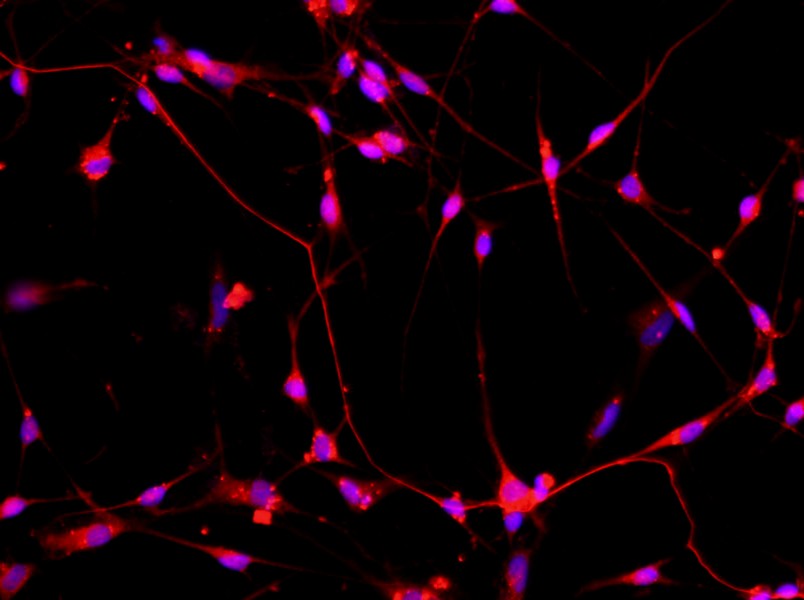 Rat Spinal Cord Neuron Complete MediumRat Spinal Cord Neuron Complete Medium - 2
