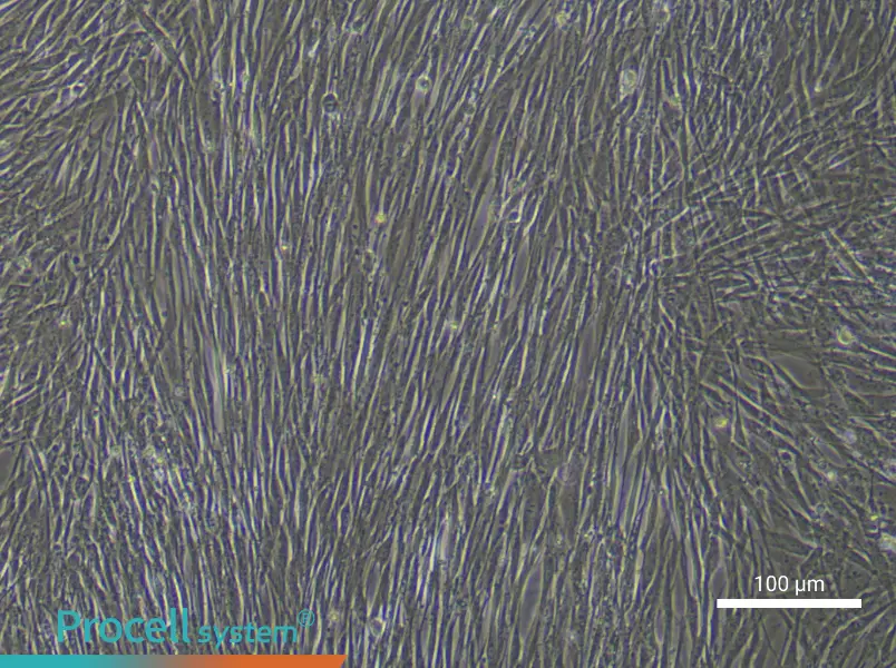 Human Lung Cancer‑Associated Fibroblast Complete Medium - 1