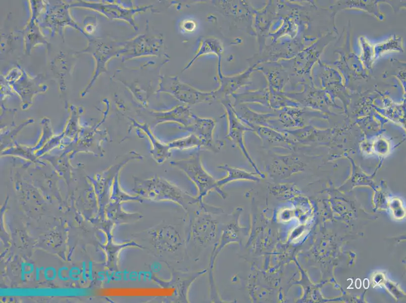 Hs 578T Cell Complete Medium - small - 5