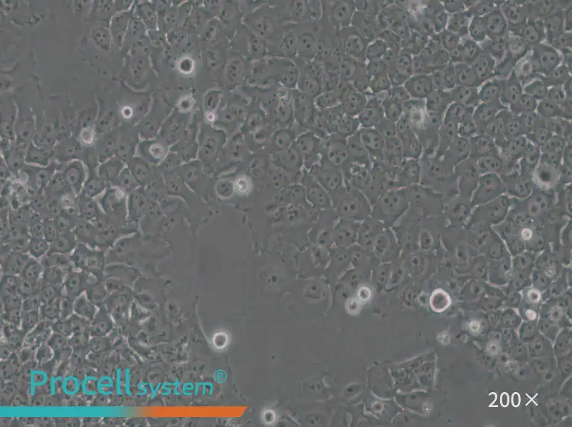 SACC-83 Cell Complete Medium - small - 5