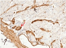 Recombinant CD146/MCAM Monoclonal Antibody-searchlist-1