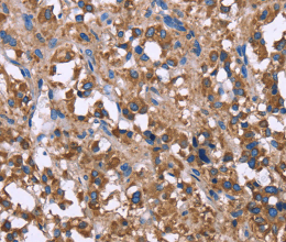 SERPINA1 Polyclonal Antibody - 2