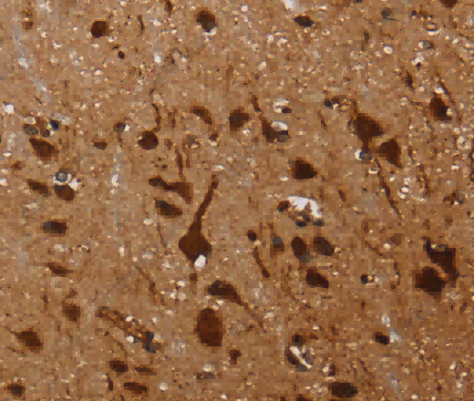 KARS Polyclonal Antibody - 2