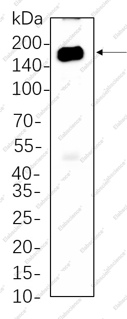 Recombinant HDAC6 Monoclonal Antibody - 1