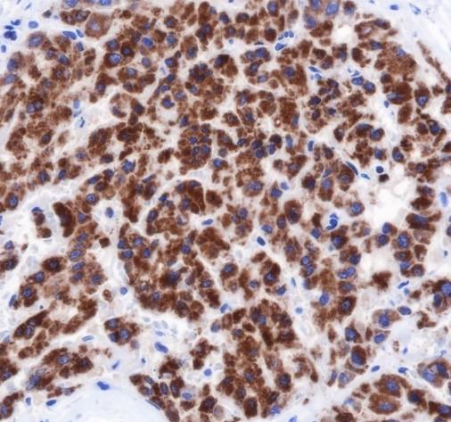 Recombinant MAO-A Monoclonal Antibody - 2